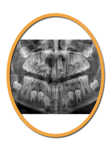 bague-dentaire-orthodontiste